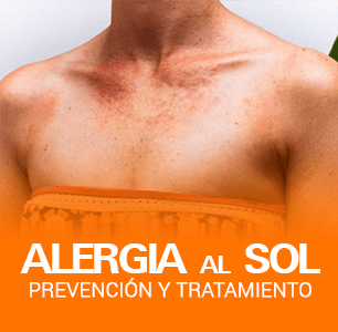 alergia-sol