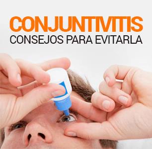 Conjuntivitis - Consejos para evitarla