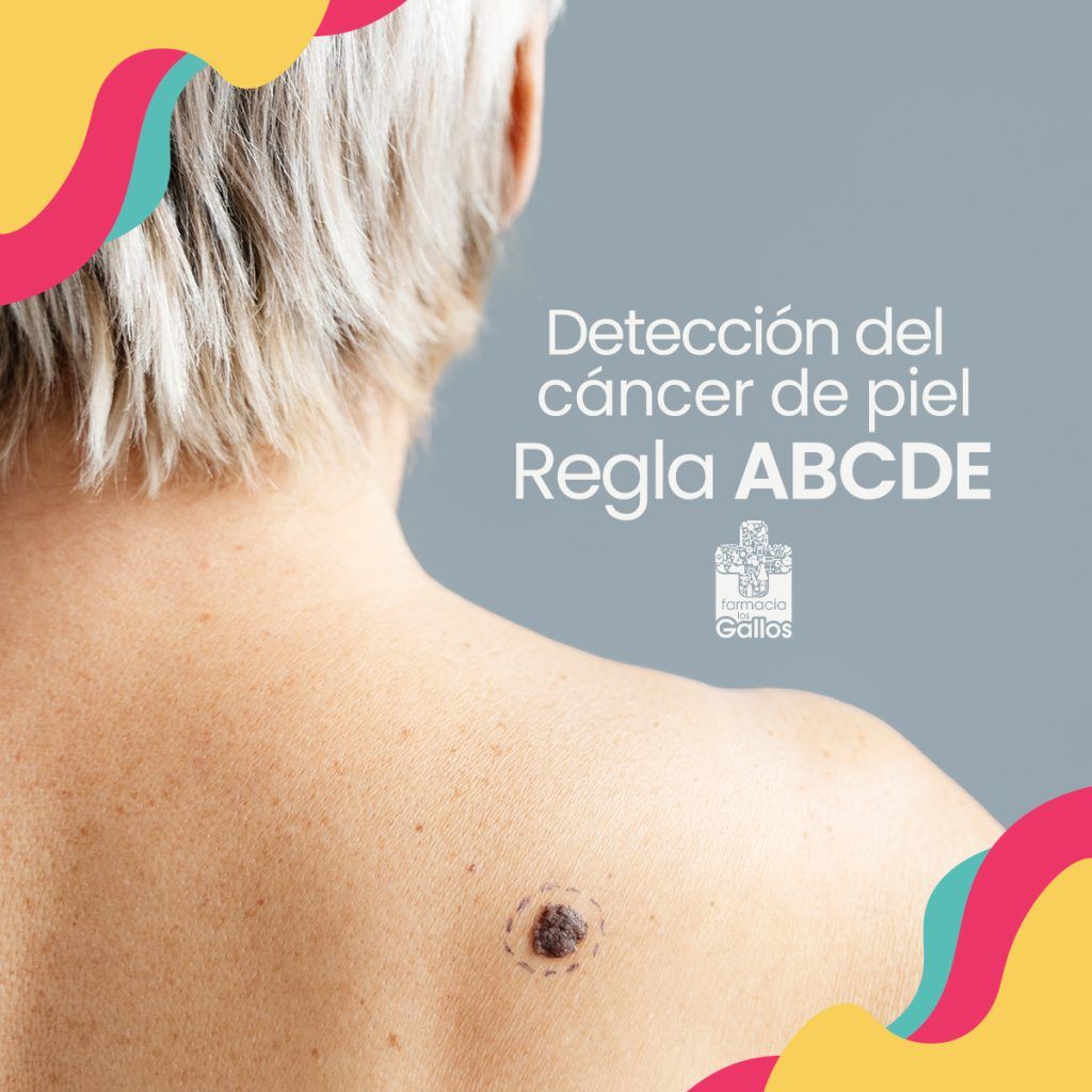 Regla ABCDE